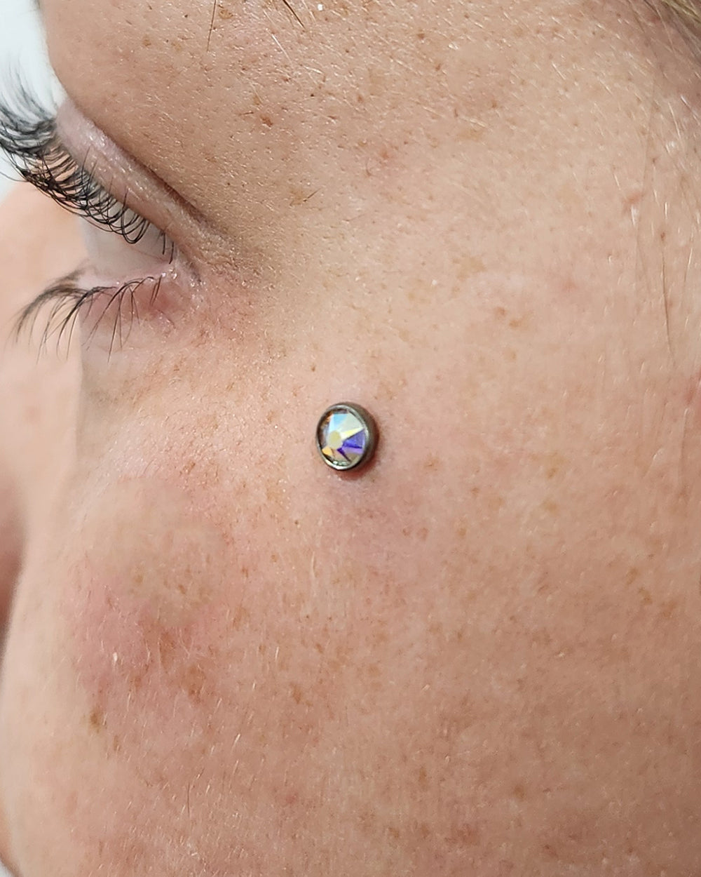 Titanium Crystal Dermal Top