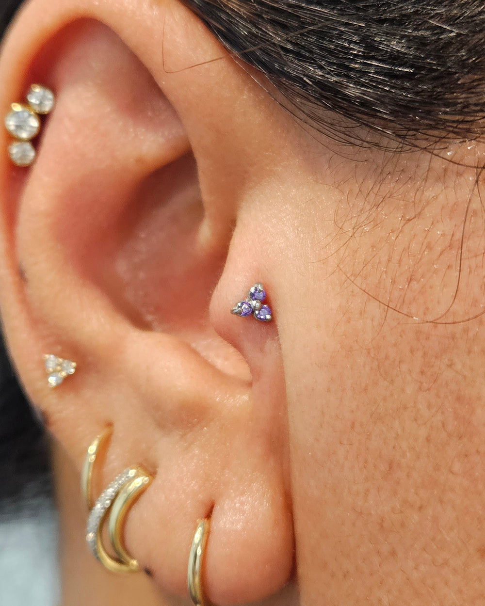 Amethyst Trinity Internal Thread Attachment